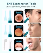 Bebird Earsight Ultra Ear Wax Removal Kit - Image 2